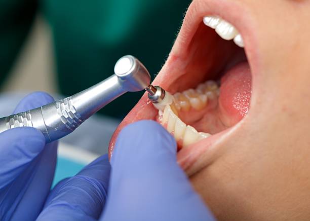 Best Dental Fillings (Composite and Amalgam)  in Natalbany, LA